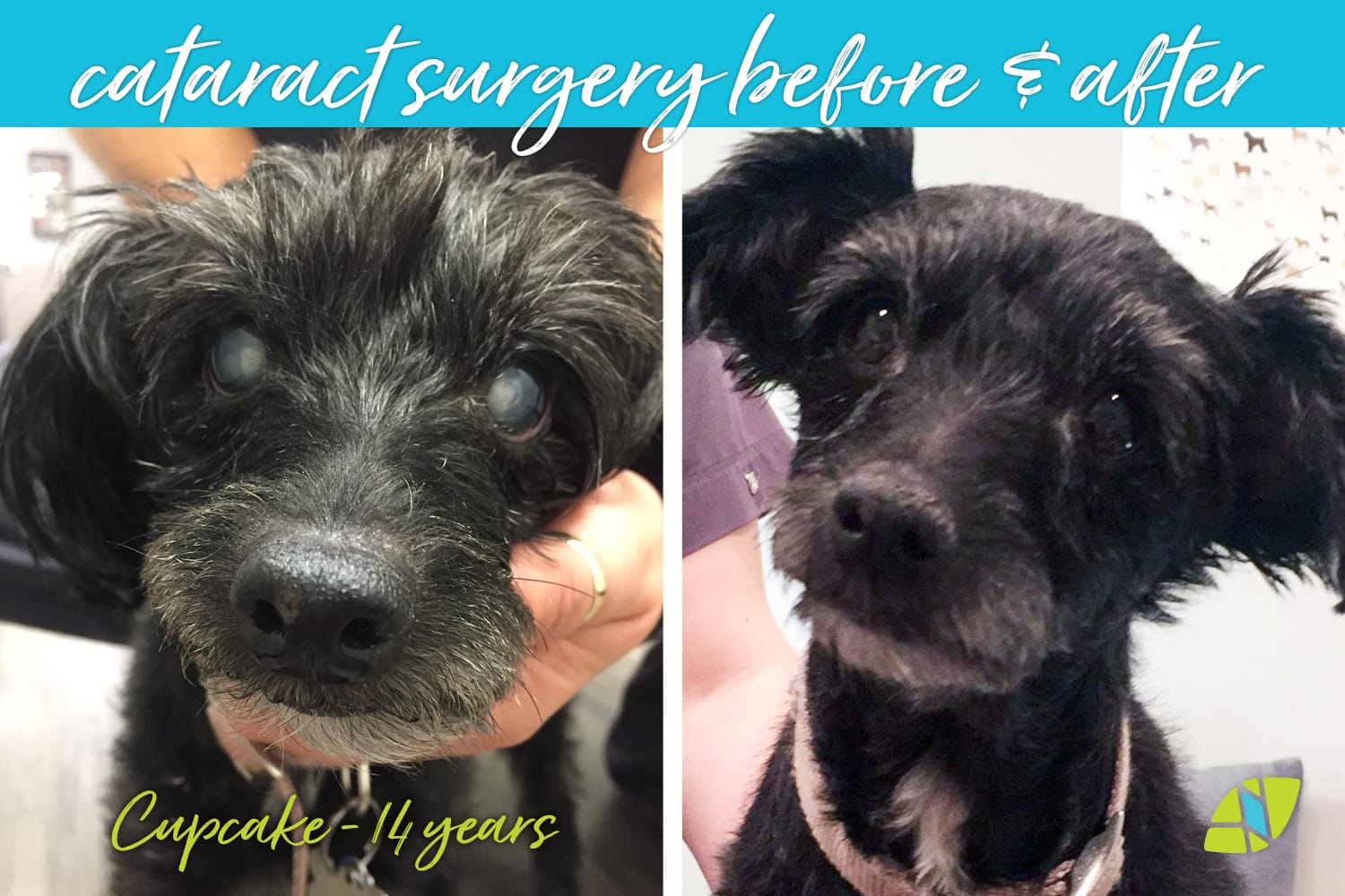 AVCVA Cataracts Surgery Before And After Cupcake 